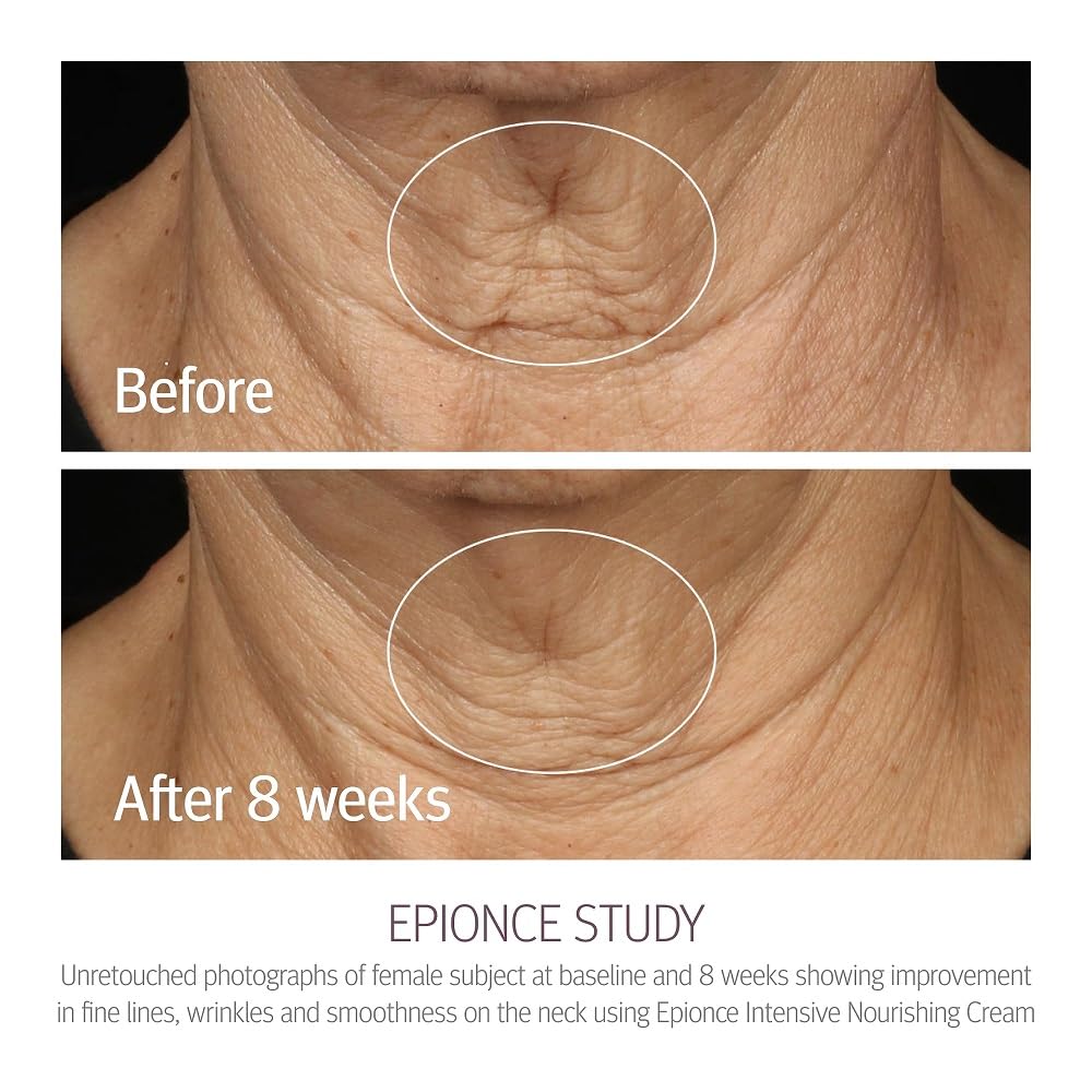 Epionce Intensive Nourishing Cream – 1.7 fl. oz