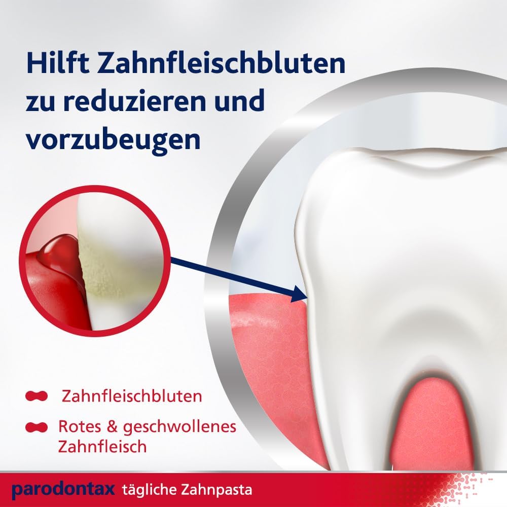 Parodontax Complete Protection Zahnpasta mit Fluorid, 4x75ml, hilft Zahnfleischbluten zu reduzieren und vorzubeugen