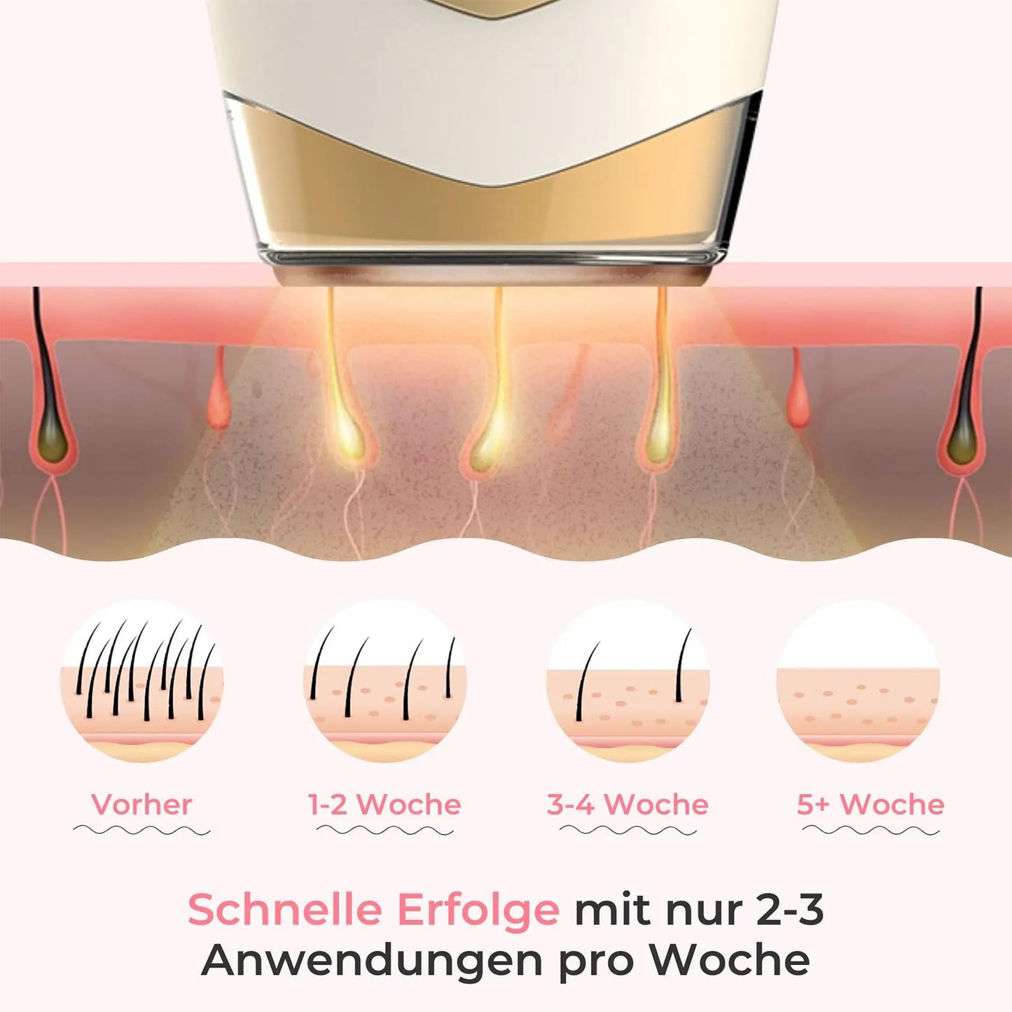Onlybabe Haarentferner Original, Onlybabe Haarentferner Ipl Pro 2.0, Onlybabe Haarentferner Intim, 2-In-1 Laser Haarentfernungsgerät, Onlybabe Skinny Haarentferner Für Frauen