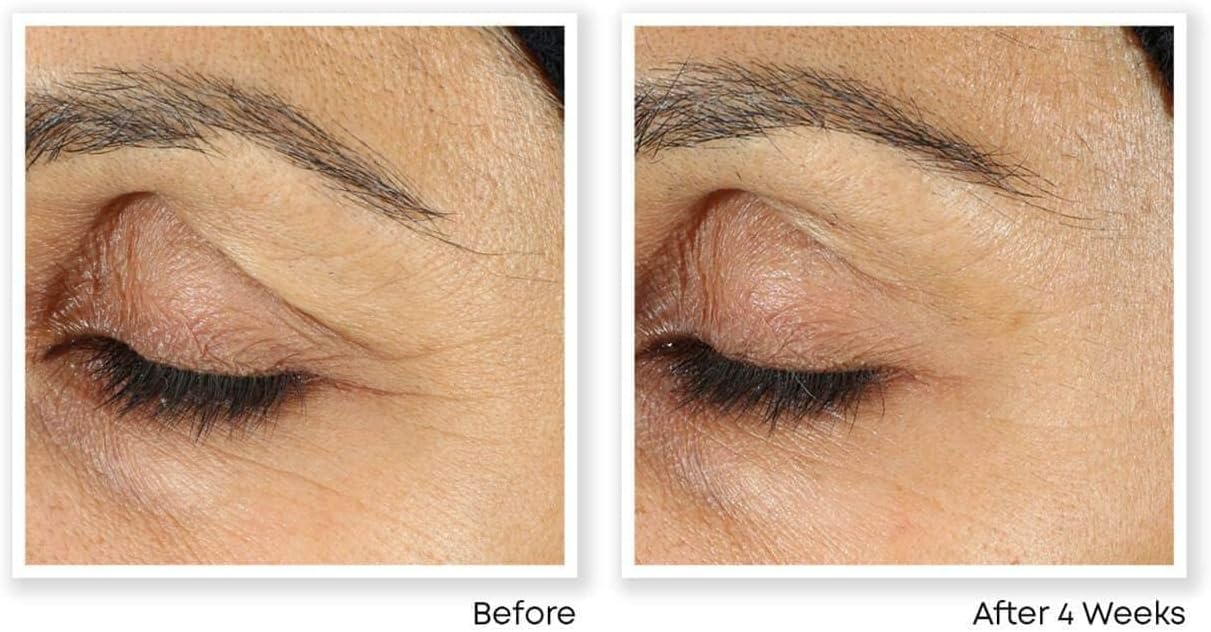 RoC Retinol Correxion Line Smoothing Eye Cream