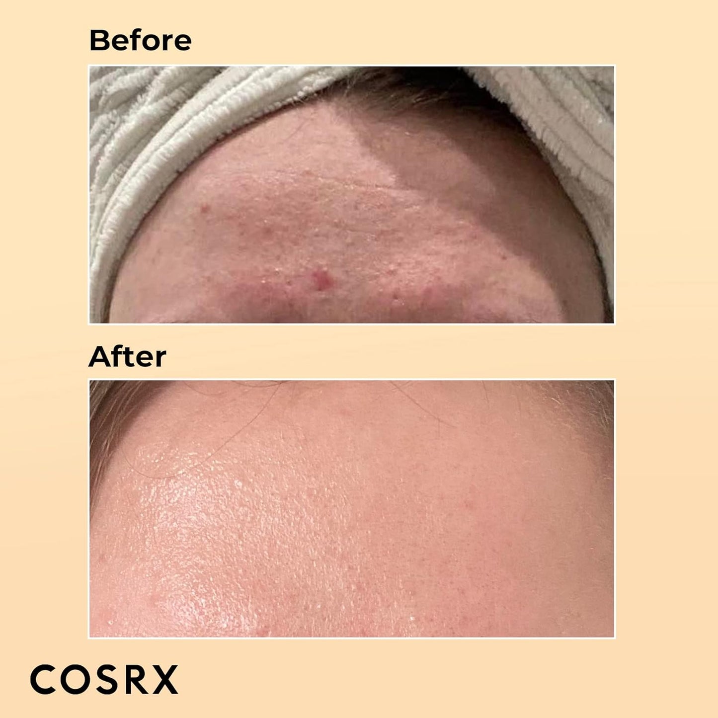 COSRX Advanced Snail 96 Mucin Power Essence – Hydrating & Repairing Serum