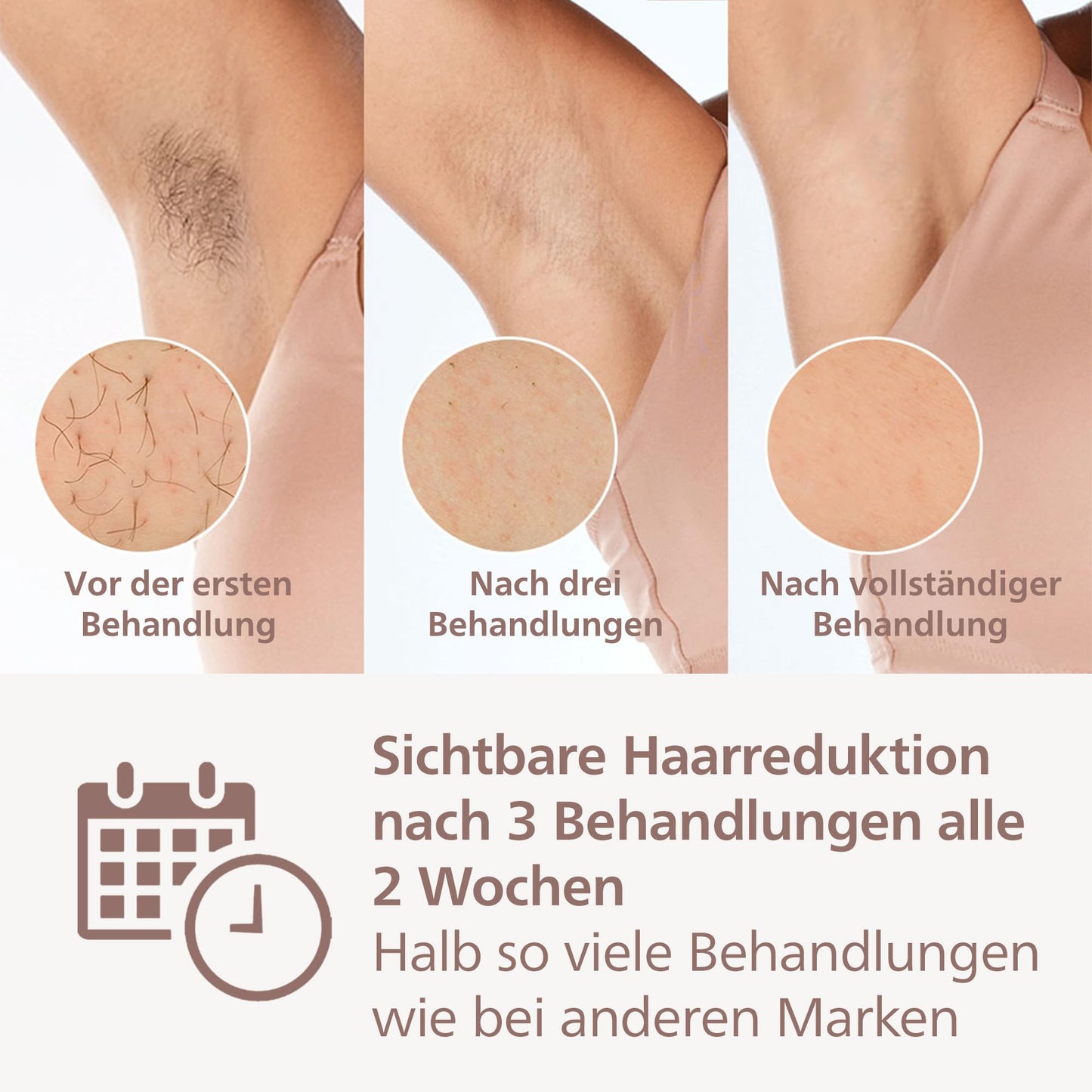 Philips Lumea IPL Haarentfernungsgerät 9000 Series – Haarentfernungsgerät mit SenseIQ Technologie, 4 Aufsätze für Körper, Gesicht, Bikinizone und Achselhöhlen, kabellos (Modell BRI957/00)