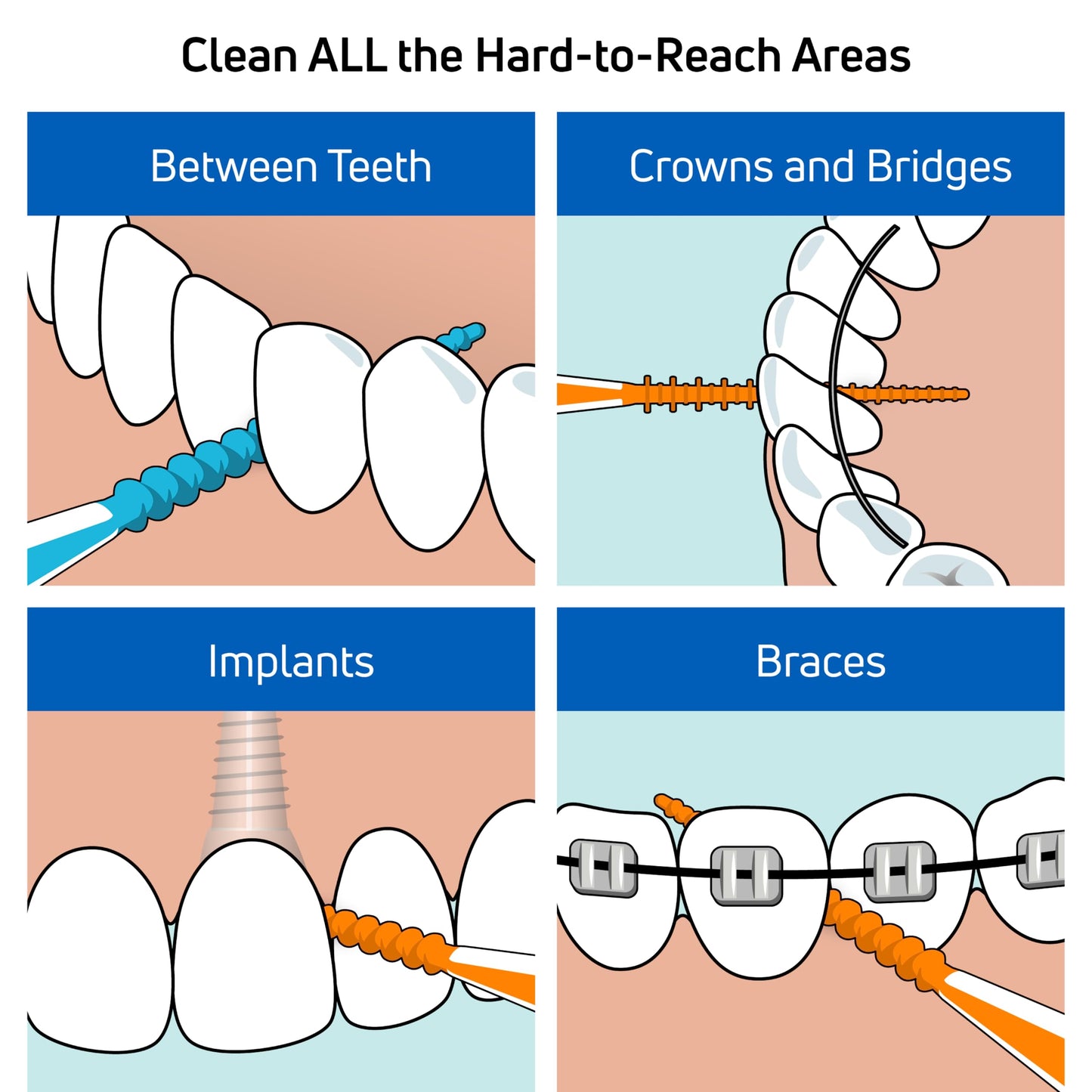 TePe EasyPick Dental Stick XS/S / 1 x 36 Stück inklusive praktischem Taschenetui / Für eine einfache, tägliche Anwendung zwischendurch und unterwegs