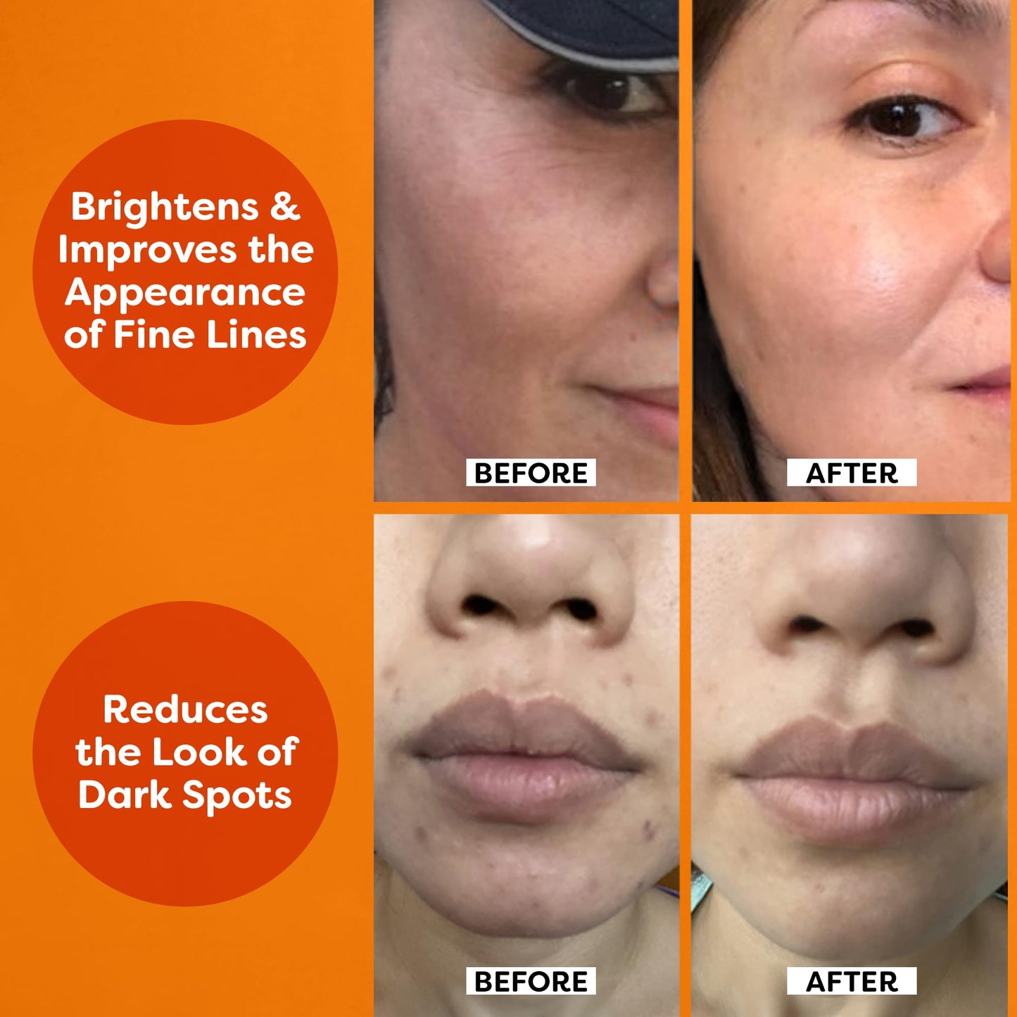 TruSkin Vitamin C Serum Brightening & Anti-Aging Skincare
