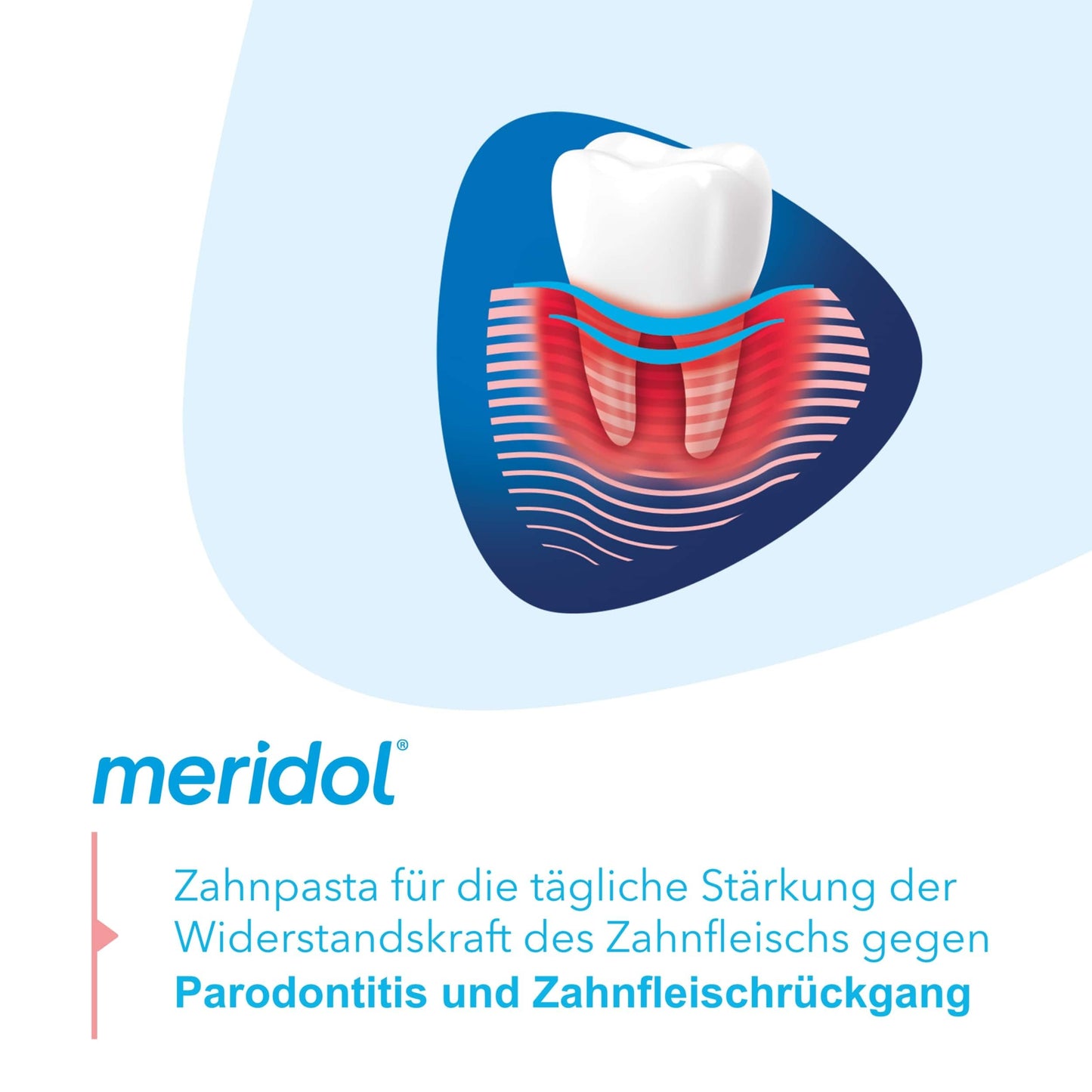 meridol Zahnpasta Parodont Expert 75 ml - Zahncreme wirkt antibakteriell und unterstützt so den natürlichen Heilungsprozess des Zahnfleisch