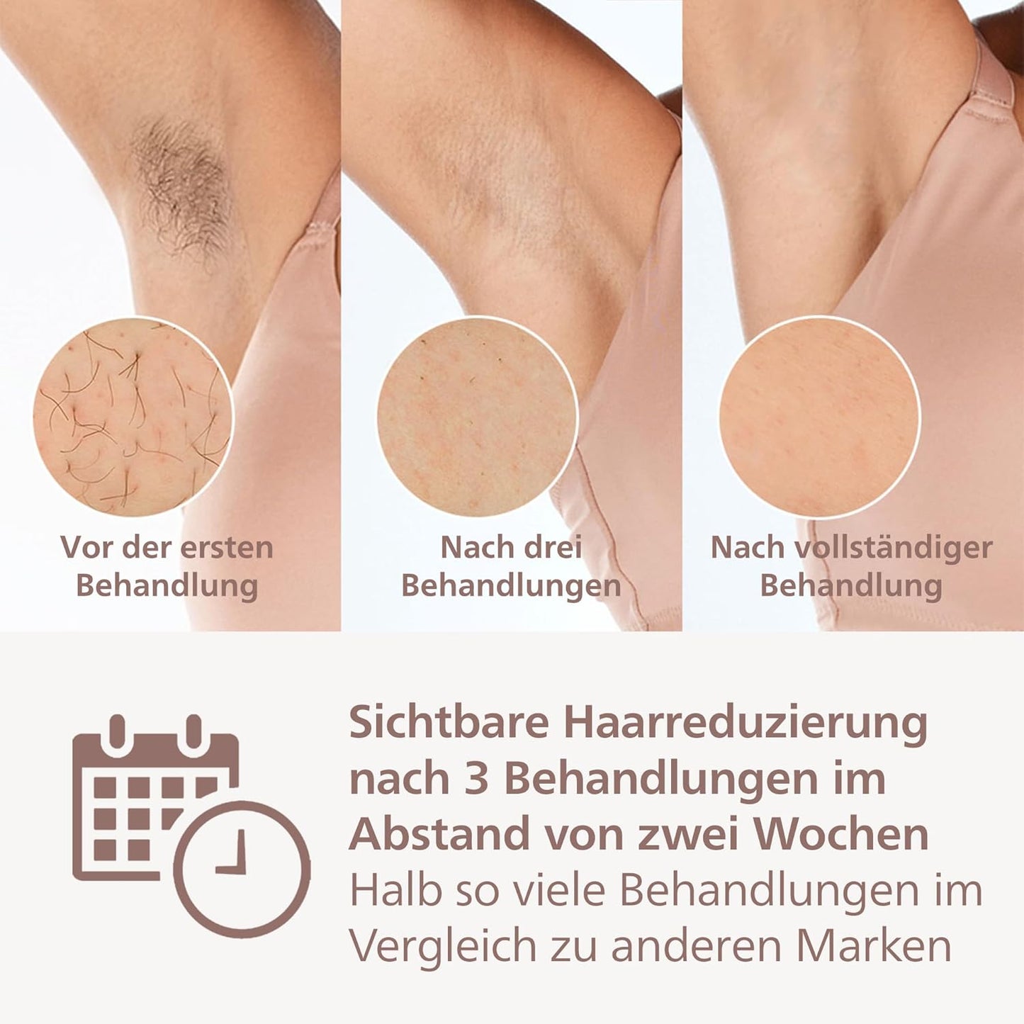 Philips Lumea IPL Haarentfernungsgerät 9000 Series – Haarentfernungsgerät mit SenseIQ Technologie, 3 Aufsätze für Körper, Gesicht und Präzision, kabellos (Modell BRI955/00)