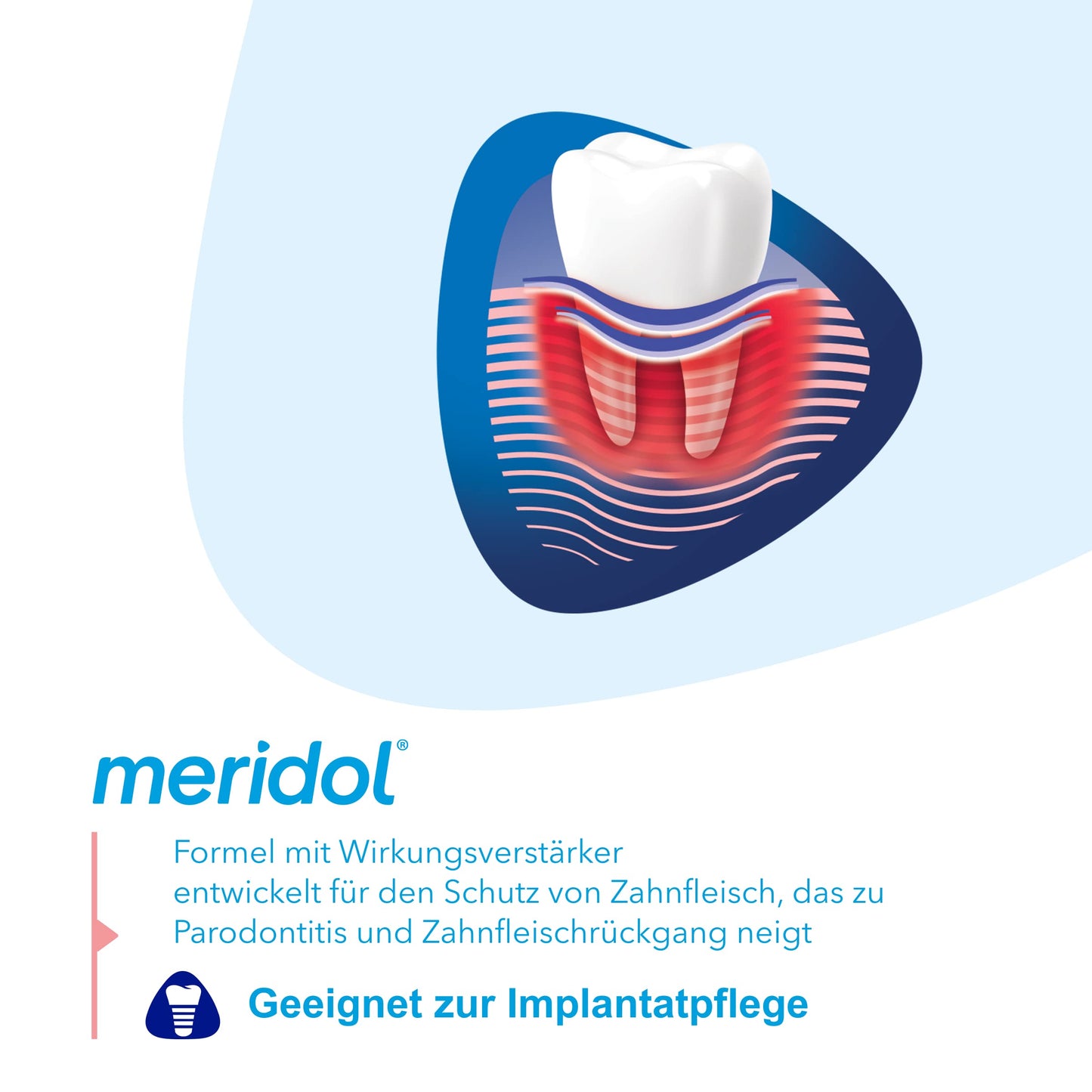 meridol Zahnpasta Parodont Expert 75 ml - Zahncreme wirkt antibakteriell und unterstützt so den natürlichen Heilungsprozess des Zahnfleisch