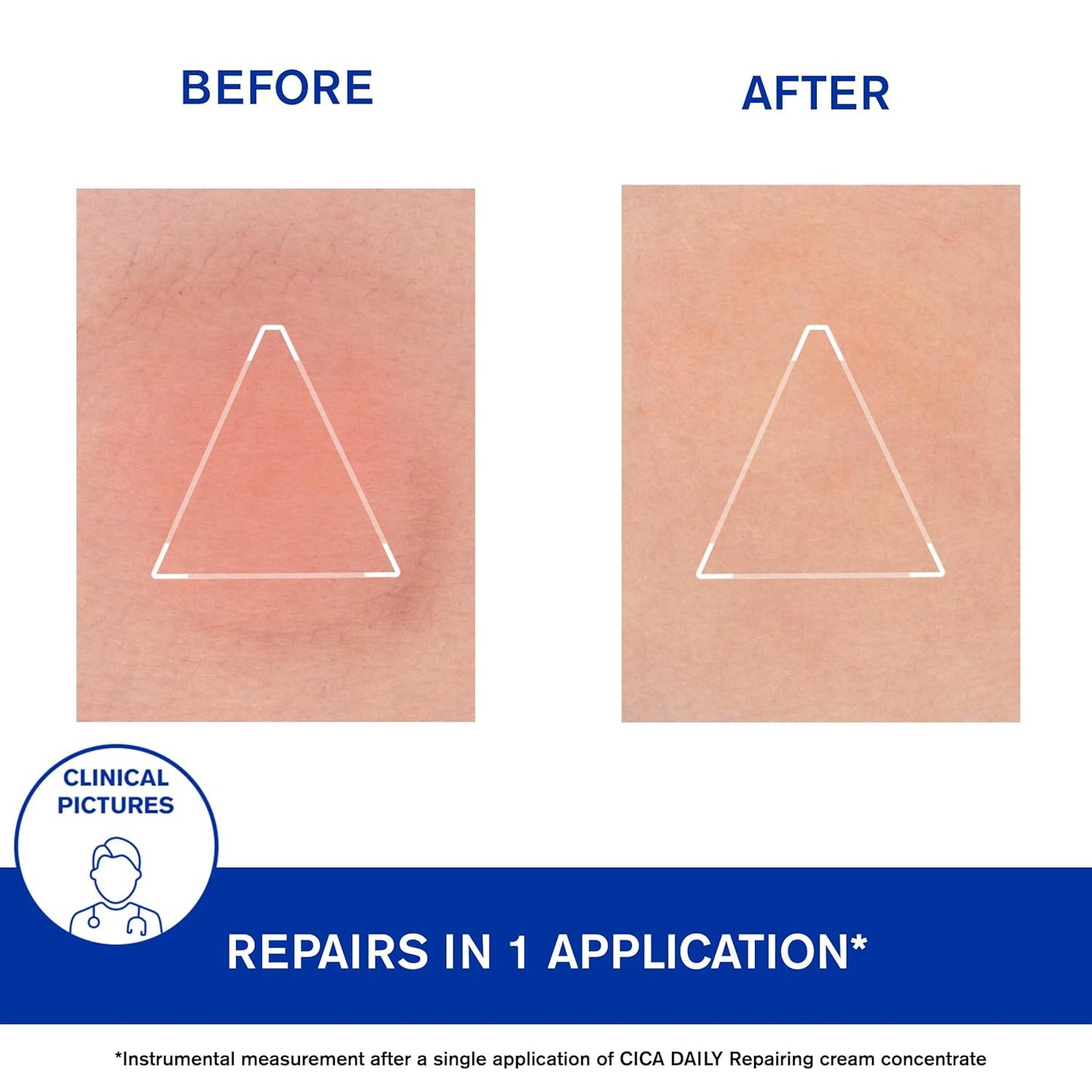 Uriage Cica-Daily Intensive Repair Serum