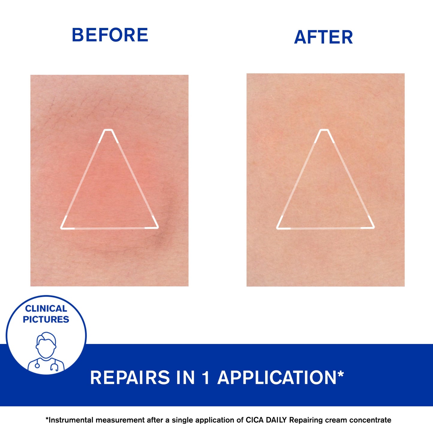 Uriage Cica-Daily Repairing Cream
