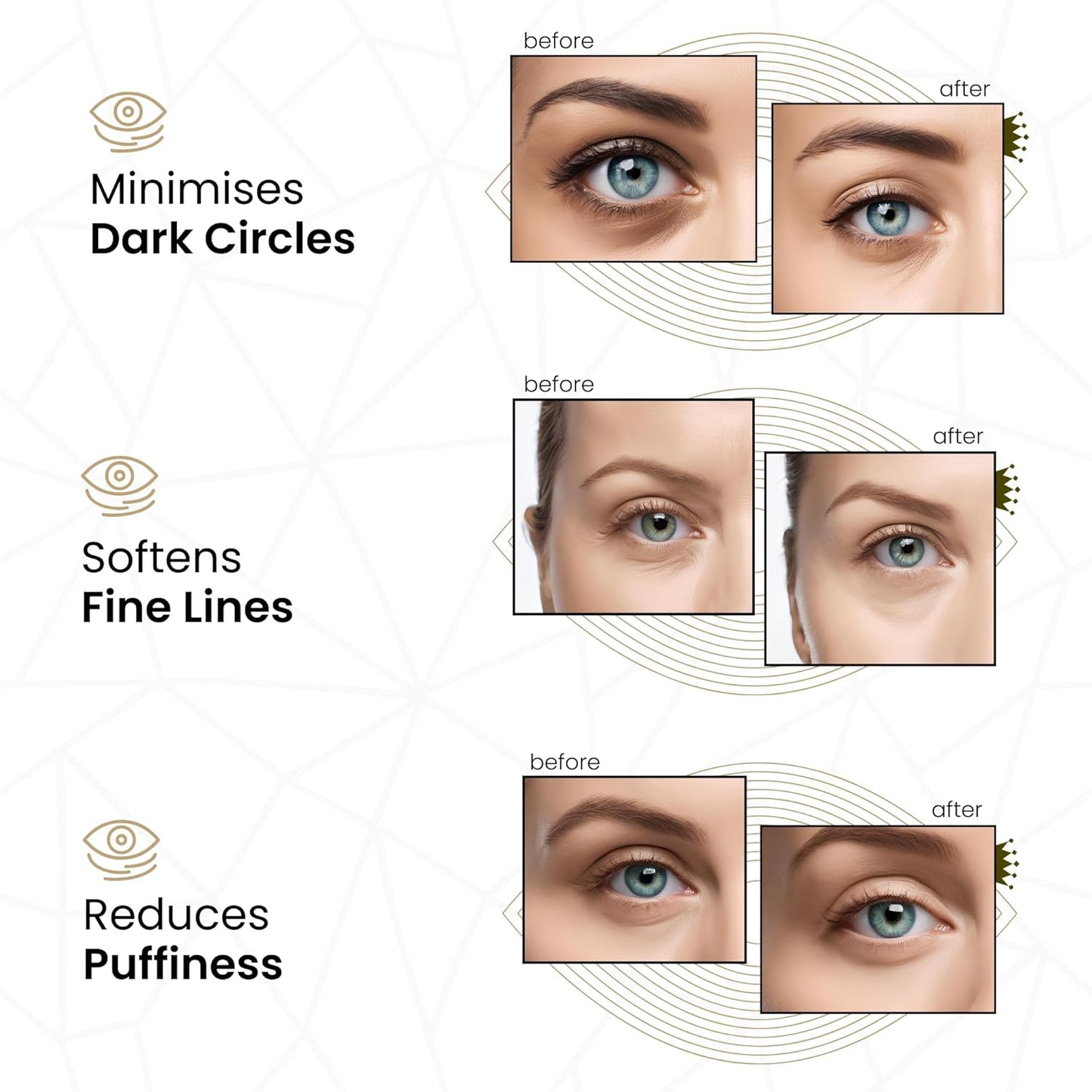 Revitale 24K Gold Under Eye Collagen Patches – 30 Pairs