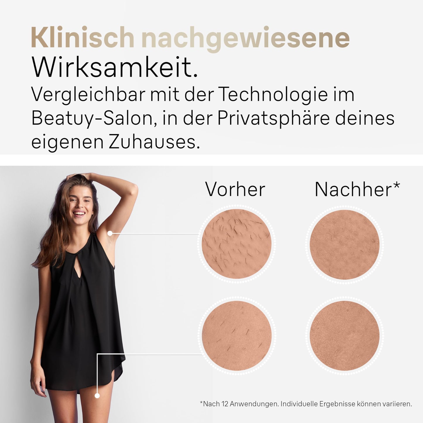 Braun IPL Silk Expert Pro 5 Haarentfernungsgerät Damen/Herren, 2 Aufsätze, sichtbare Haarentfernung, Designed In Germany, Venus Rasierer, Alternative zu Laser Haarentfernung, PL5157, weiß/gold