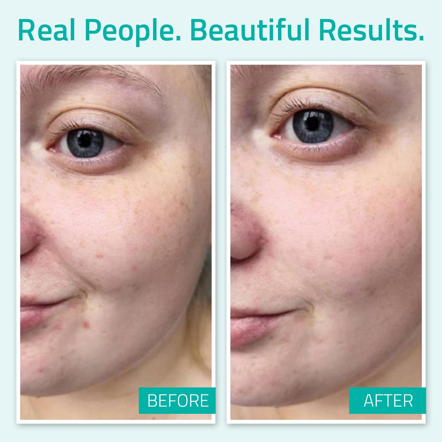 YEOUTH Hyaluronic Acid Serum – Intense Hydration for All Skin Types