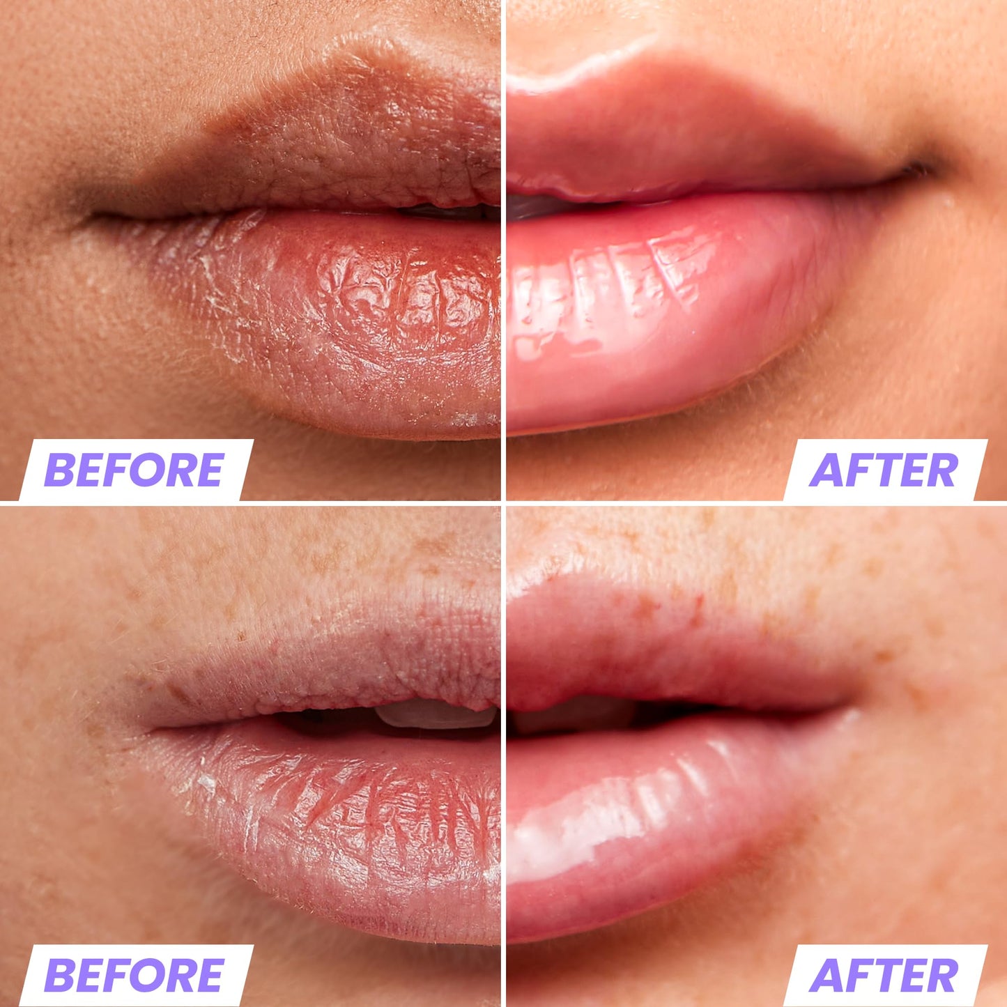 Wonderskin Lip Oil Hydrating & Moisturizing Lip Rehab Serum