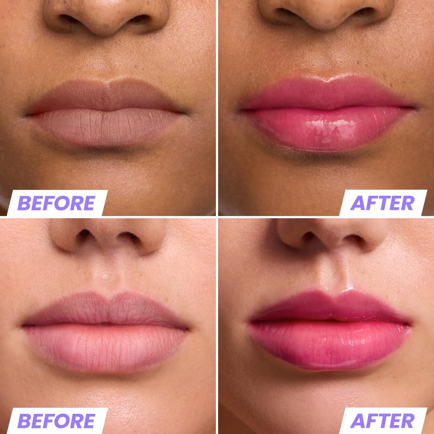 Wonderskin Lip Oil Hydrating & Moisturizing Lip Rehab Serum