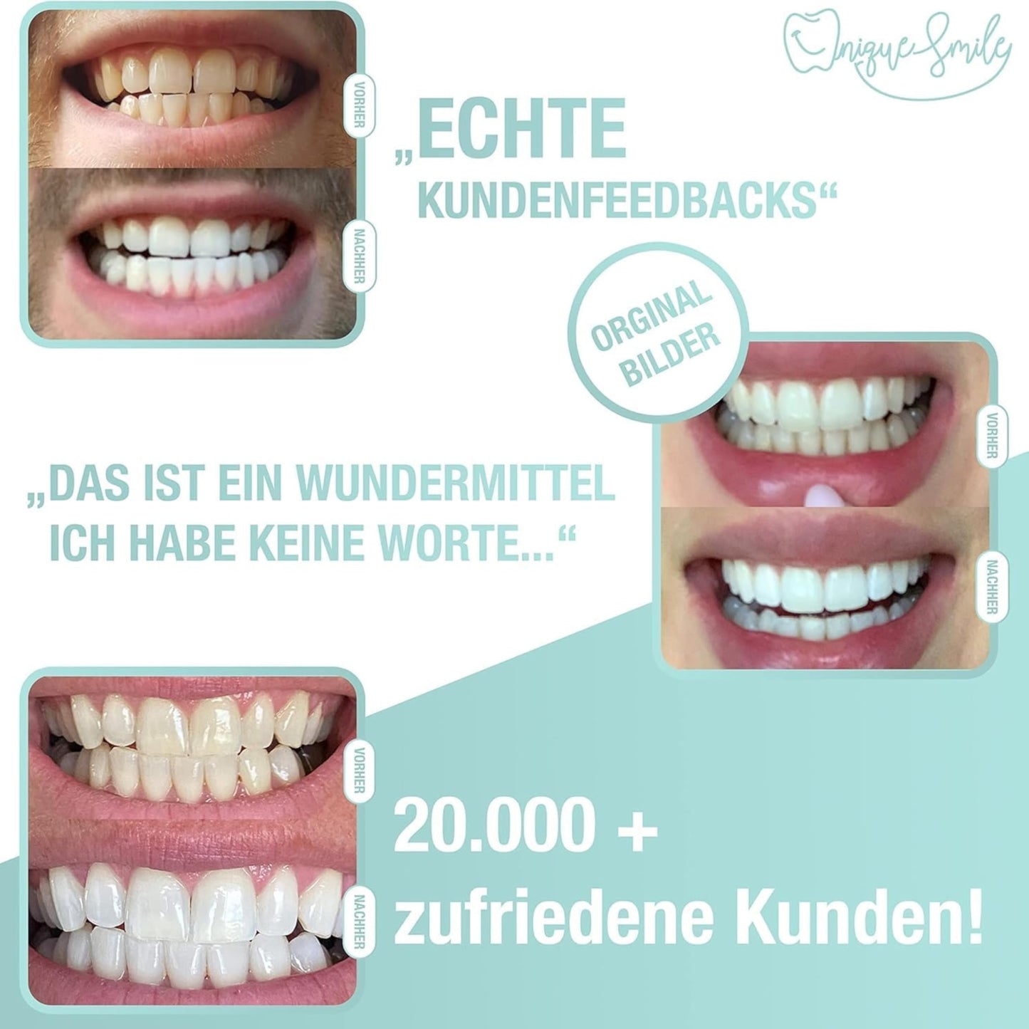Hochwertiges Teeth whitening kit von UniqueSmile - Testsieger 2023-100 Tage risikofrei testen - All in One Bundle für Zahnaufhellung & weiße Zähne - Zahn Bleaching Set (Basic-Set)
