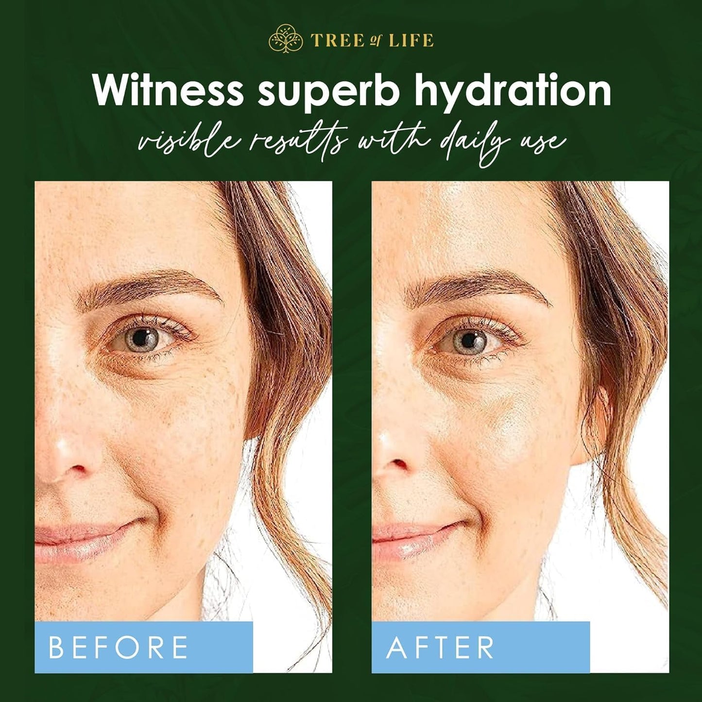 Tree of Life Beauty Hyaluronic Acid Serum (60ml)